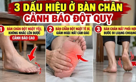 3 dấu hiệu ở bàn chân cảnh báo đột quỵ, số 1 cảnh báo cao