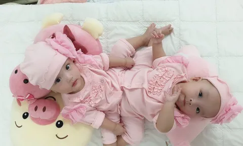 Những ca phẫu thuật song sinh dính liền nổi tiếng trong y học Việt Nam