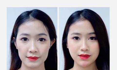Tin vui cho người bị gò má cao thoát khỏi tướng 'Sát phu'