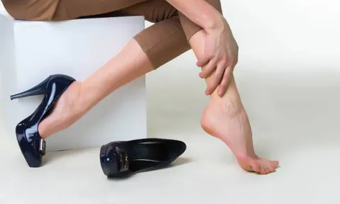 BoniVein – Bí quyết hỗ trợ 'đánh bại' cả bệnh trĩ và suy giãn tĩnh mạch chân