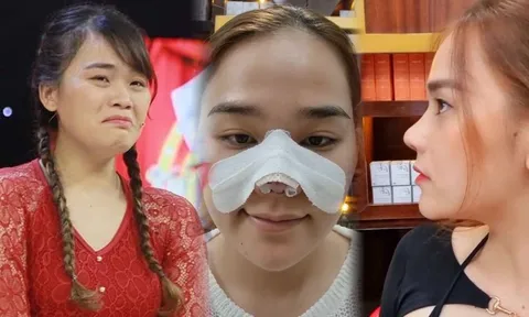 Sửa nhưng không ưng, 'thánh sún' Ngân Thảo hối hận vì đã can thiệp dao kéo: Nhan sắc hiện thế nào?