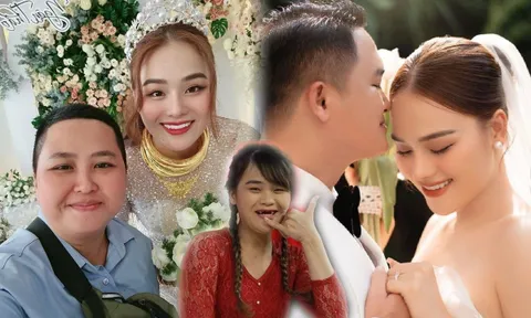 Từng nghèo không có tiền làm răng, 'thánh sún' Ngân Thảo nay đeo vàng trĩu cổ ngày cưới