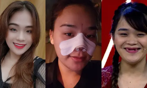 Thánh sún Ngân Thảo - cô gái được Ngô Kiến Huy nâng đỡ công khai trùng tu nhan sắc