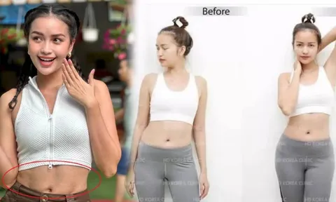 Ngọc Châu vô tình để lộ vóc dáng kém nuột nà giữa nghi vấn phẫu thuật thẩm mỹ