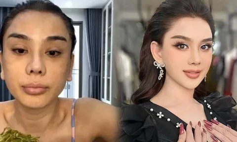 Lâm Khánh Chi đạt thành quả lớn khi chi tiền tỷ thực hiện 'cuộc cách mạng' nhan sắc