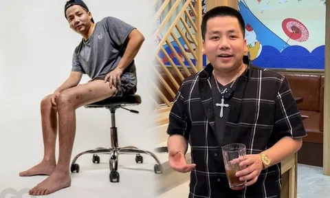 Chi tiền tỷ thẩm mỹ, Khoa Pug khoe đôi chân 'dài miên man' trên tạp chí Mỹ