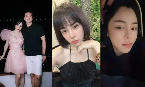 Bạn gái Huỳnh Anh chia sẻ chuyện 'đập mặt xây lại', ngoại hình gây chú ý