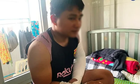 Tình trạng hiện tại của nam shipper bị đánh gãy 2 tay khiến ai nấy đều xót xa