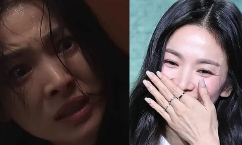 Sự thật sau làn da sần, tái nhợt của Song Hye Kyo trong The Glory