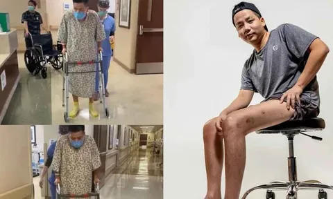 Chi tiền tỷ để kéo dài chân nhưng lại bị chê làm điều 'vớ vẩn', Khoa Pug đã lập tức có động thái