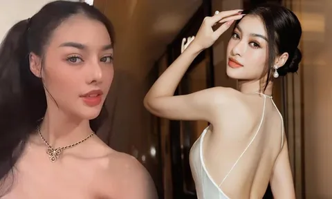 Á hậu Kiều Loan để lộ dấu hiệu bất thường trên mặt sau khi thừa nhận can thiệp 'dao kéo'