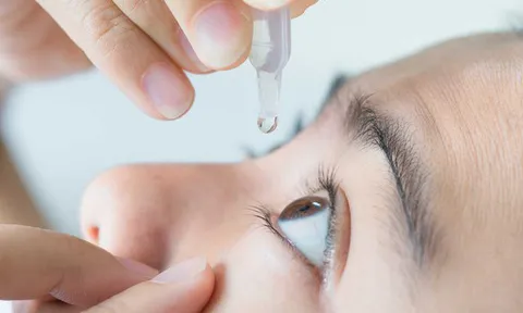 Cách giảm khô mắt cho dân văn phòng, phương pháp đơn giản mà nhiều người không chú ý