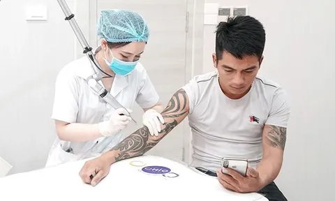 Thực hư việc xóa xăm bằng Laser tại cơ sở thẩm mỹ
