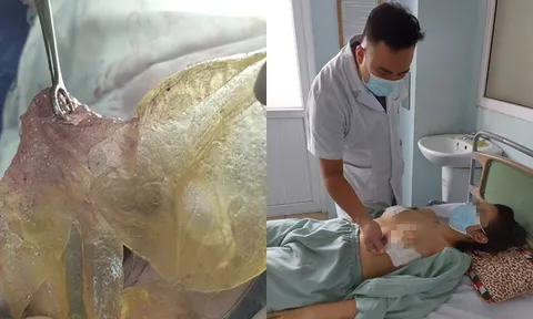 Hà Nội: Bị vỡ túi ngực sau 6 năm phẫu thuật