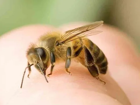 Cách chữa ong đốt hết sưng nhanh nhất: Lưu lại để áp dụng ngay khi cần