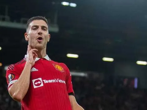 Diogo Dalot gây chú ý với video triệt lông