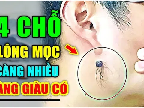 Lông mọc chỗ này điềm báo phát tài: Ngồi không cũng giàu, ai có thật đáng chúc mừng