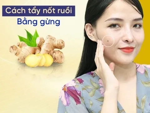 Tự tẩy nốt ruồi bằng gừng cực nhanh, an toàn và không để lại sẹo