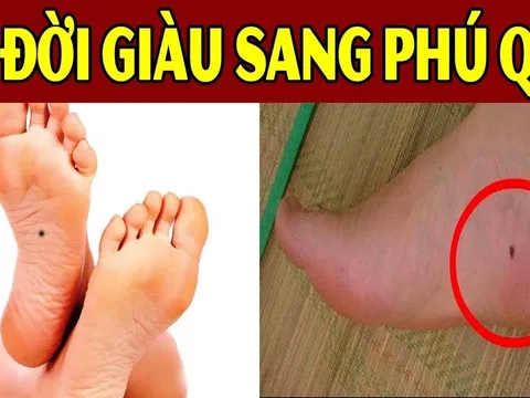 Nốt ruồi Thần Tài đánh dấu, giữ lại là phúc, xóa là mất lộc: Quanh bạn ai có không?