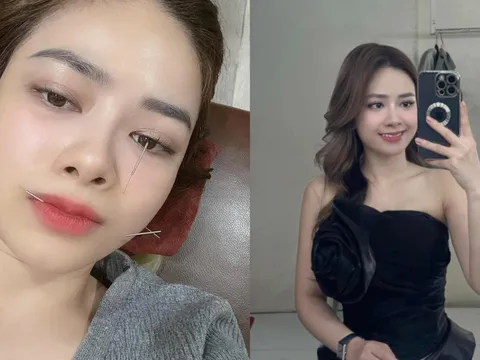 Sao nữ Vbiz liệt dây thần kinh số 7 chia sẻ tình hình hiện tại, cảnh báo mọi người không làm việc này