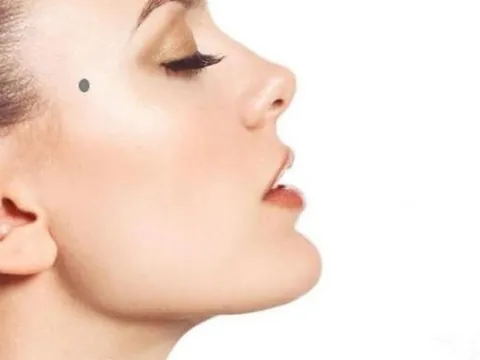 3 vị trí nốt ruồi điềm báo xui xẻo, dấu hiệu của trắc trở đường đời