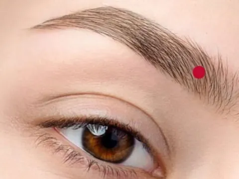 3 nốt ruồi 'vàng' trên khuôn mặt phụ nữ: Ai sở hữu, cuộc đời phúc lộc đầy nhà