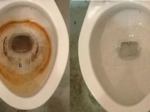 Bồn cầu bám cặn vàng: Không cần cọ rửa nhiều, làm cách này trắng sáng, thơm tho như mới