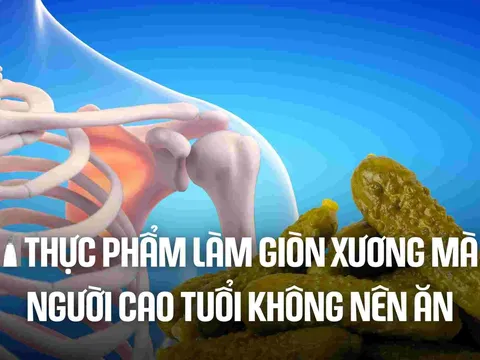 3 loại nước là 'vua rút cạn canxi, uống nhiều xương giòn, dễ gãy