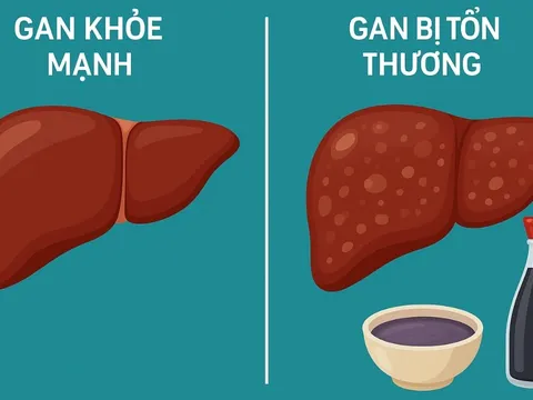 Cảnh báo: Loại gia vị quen thuộc này có thể âm thầm hại gan mà nhiều người Việt chưa biết