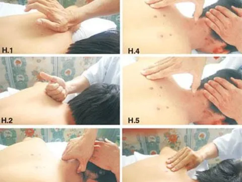 6 thao tác bấm huyệt chữa đau vai gáy hiệu quả