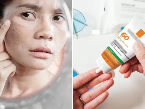 Sai lầm khi thoa kem chống nắng làm da sạm nám nhiều hơn