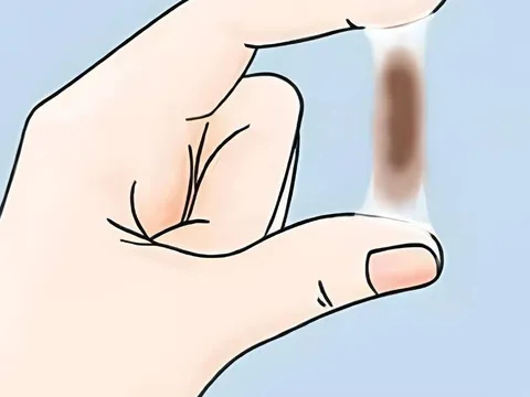Chảy máu sau quan hệ – Cảnh báo ung thư cổ tử cung nhiều người chủ quan bỏ qua