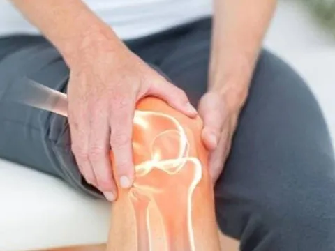 3 loại nước bị ví như 'vua rút cạn canxi' – Uống thường xuyên khiến xương giòn yếu