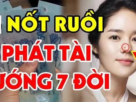 3 nốt ruồi Phá Tướng, Hao Tài : Ai có nên xóa ngay trước khi quá muộn, kiểm tra ngay xem bạn có không?