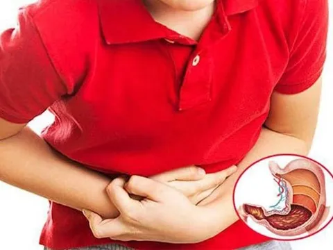 7 dấu hiệu cảnh báo bệnh dạ dày đã đi vào giai đoạn nặng: Có 1 cũng nên đi khám sớm