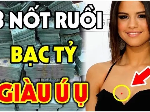 3 nốt ruồi là Hố Chôn Tiền: Ai có được hút bạc tỷ, đừng dại xóa đi