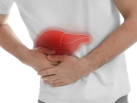10 dấu hiệu cảnh báo bệnh Gan có thể nhận ra bằng mắt thường nhưng nhiều người chủ quan