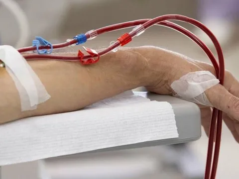 7 dấu hiệu suy thận giai đoạn cuối: Chủ quan tính mạng tính bằng tháng