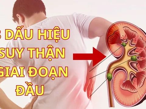 8 Dấu Hiệu Suy Thận Giai Đoạn Đầu: Phát hiện sớm cứu cả cuộc đời