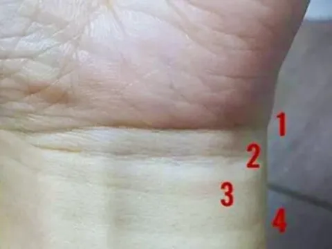 Nhìn vào 4 ngấn cổ tay: Biết ngay cuộc đời sung sướng Tiền Nhiều hay Nghèo Khổ