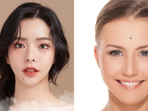 Người sở hữu 1 trong 3 nốt ruồi này đều mang phú quý, về giàu tiền đầy két, giàu 3 đời