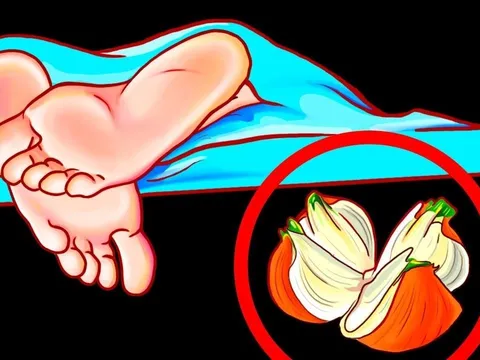 Đi ngủ đặt 1 củ hành tây ở đầu giường: Mẹo hay 10 nhà thì 9 nhà không biết cực kỳ cần thiết