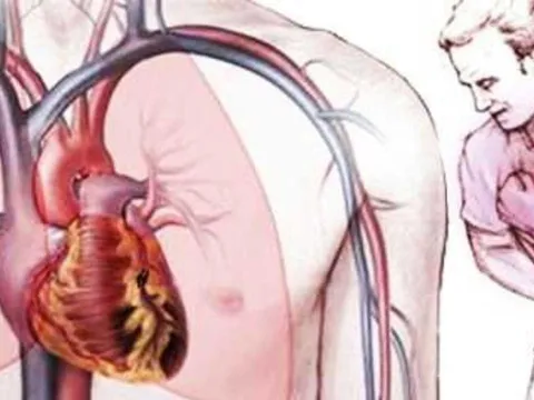 Vì sao tim ít khi bị ung thư? Lý do ít ai ngờ đằng sau sự “miễn nhiễm” đặc biệt của trái tim