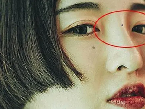 4 nốt ruồi hao tài: Ai có dù tài ba tới mấy cũng khó thoát nghèo