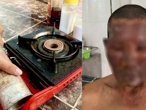 Bình gas mini phát nổ, 8 người nhập viện, lưu ý cách dùng để tránh họa bình gas mini
