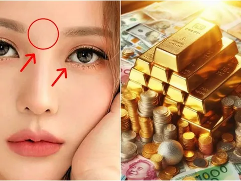 Người có 3 điểm này trên mặt Điềm Báo Phát Tài: Tiền vào như nước, thăng quan giàu có