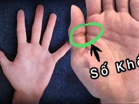 Xoè bàn tay xem: Ai có 1 điểm này phúc mỏng - phận bạc, khó mà thoát nghèo