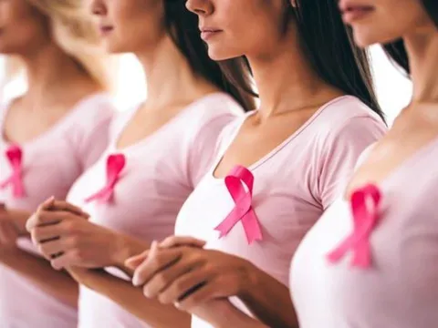 12 Yếu Tố Làm Tăng Nguy Cơ Mắc Ung Thư Vú: Phụ Nữ Nên Biết Để Phòng Ngừa Sớm