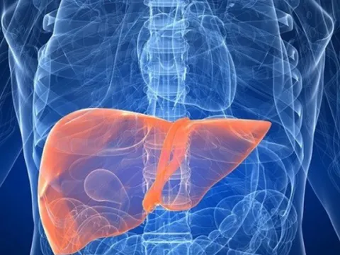 7 dấu hiệu của suy gan giai đoạn đầu, đi viện sớm để kéo dài sự sống: Số 2 đặc biệt phổ biến