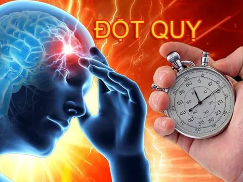 Thấy 4 bất thường bất thường này khi đi ngủ, cẩn thận nguy cơ đột quỵ